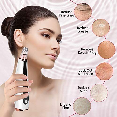 Electric Blackhead Remover Vacuum | Pore Cleaner & Facial Skin Care Tool