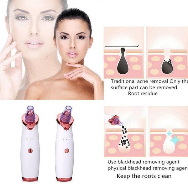 Electric Blackhead Remover Vacuum | Pore Cleaner & Facial Skin Care Tool